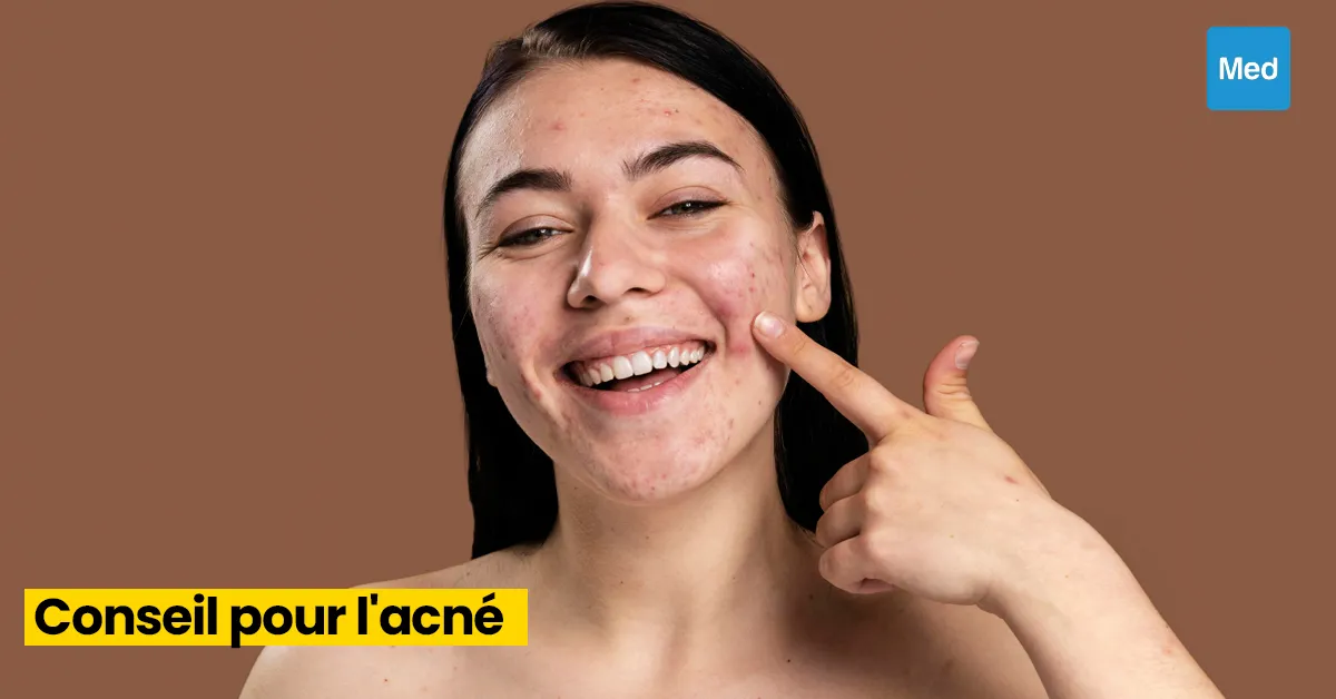 L'Acné : Conseils Pratiques pour une Peau Claire